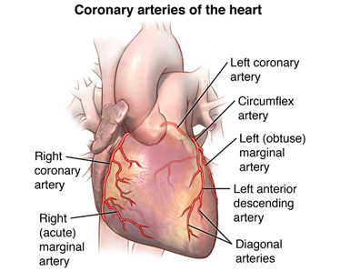 coronary-artery-disease-2